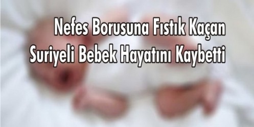 Nefes Borusuna Fıstık Kaçan Suriyeli Bebek 